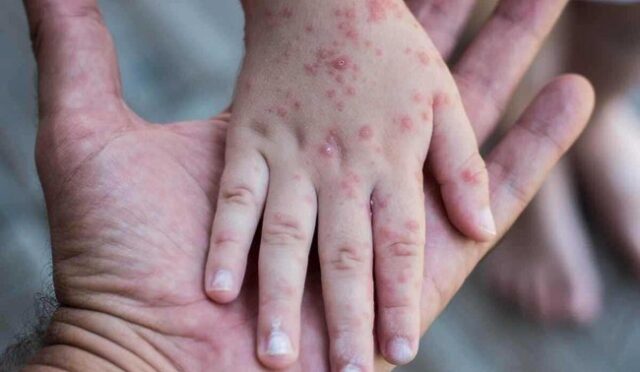 17422964131791327949