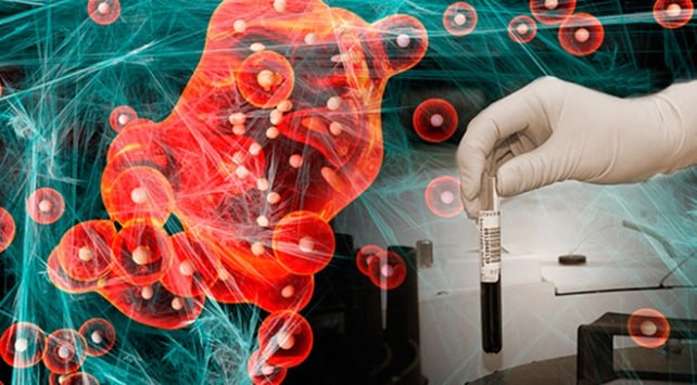 YAPAY ZEKA İLE KANSERDE AKILLI TEDAVİ YÖNTEMİ