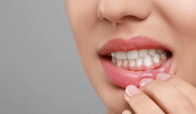 17678725451386493134