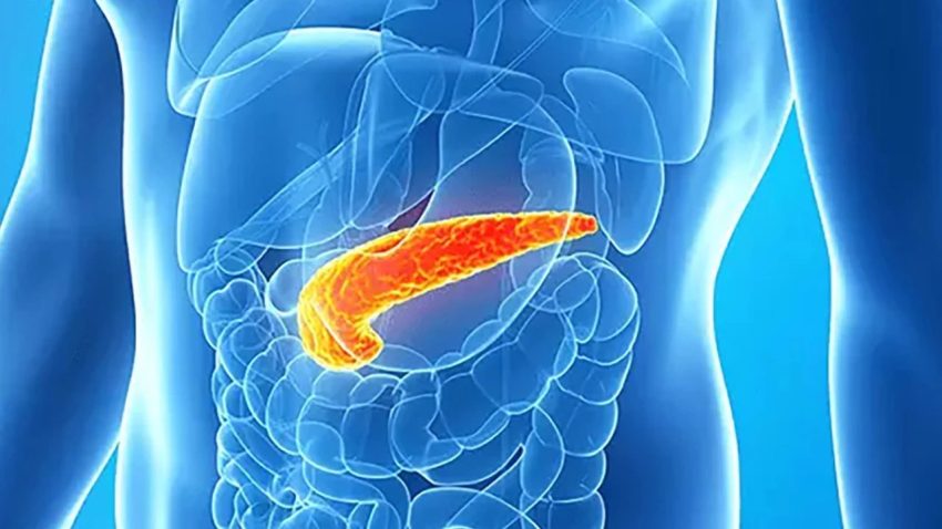 PANKREAS KANSERİNDE ÜÇLÜ TEDAVİ UMUT VERDİ